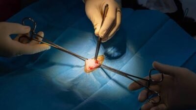 Explore appendix surgery