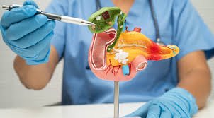 gallbladder stone treatment